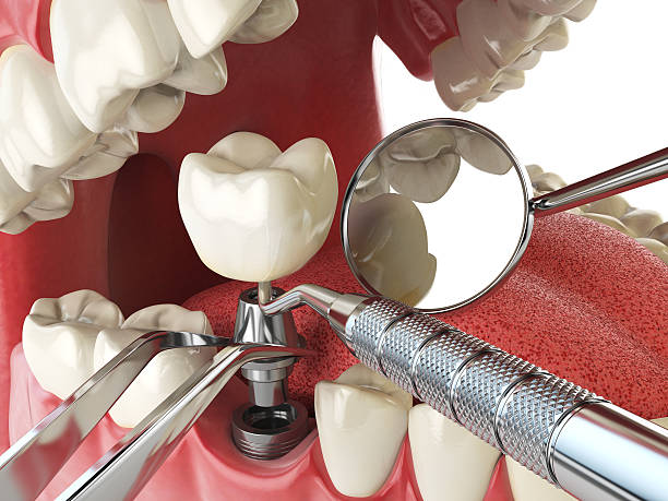 , ND Emergency Dentist Company